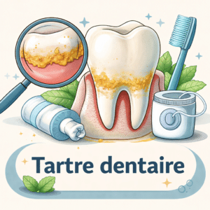 Tartre dentaire sur les dents avec ses symptômes, ses causes et ses traitements